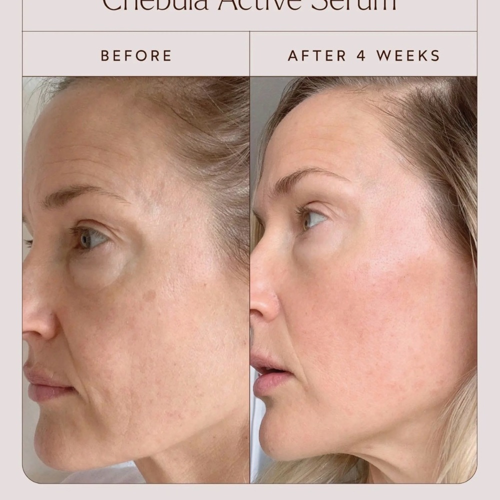 Chebula Active Serum - Pure White - Picture 3 of 6